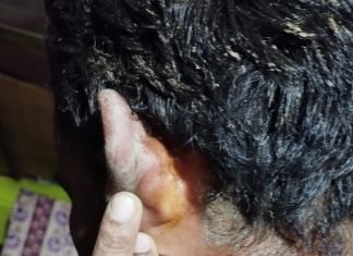 भाजपा पूर्व मंडल अध्यक्ष ने स्कूल संचालक और शिक्षकों को सरेआम पीटा, कुंडेश्वर टाइम्स ब्यूरो अनुराग द्विवेदी की रिपोर्ट